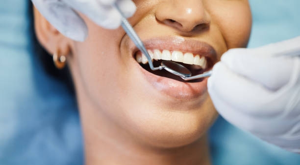 Best Emergency Root Canal Treatment in Midway, NC