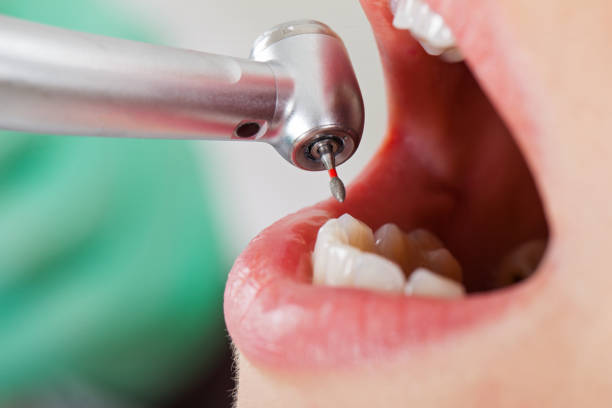 Best Orthodontic Emergency Dentist in Midway, NC